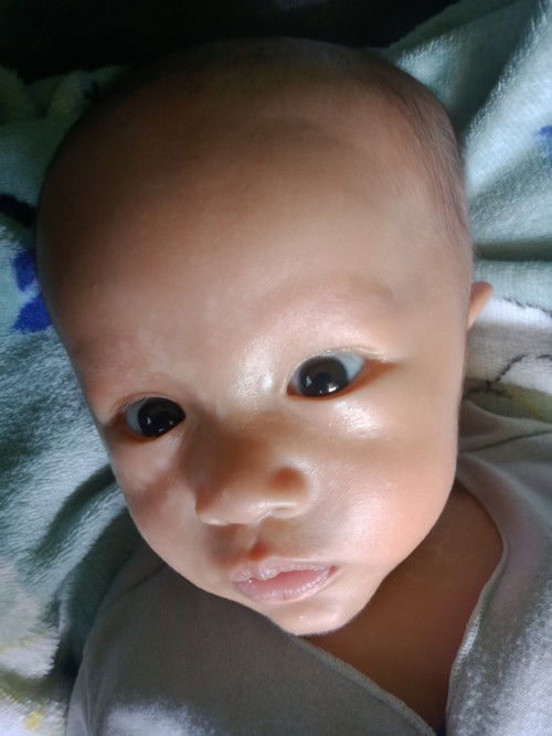 Bercak putih di wajah dan leher