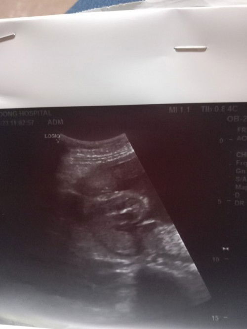 แม่ๆช่วยดูหน่อยค่ะว่าหญิงรึชาย