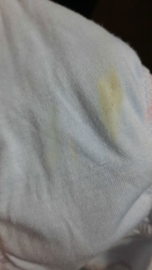 Keputihan di usia kehamilan 15 minggu 5 hari