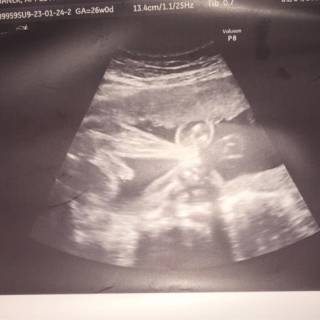 IS ANYONE HERE CAN CONFIRM IF 100% BOY SI BABY ? thankyou po in advance