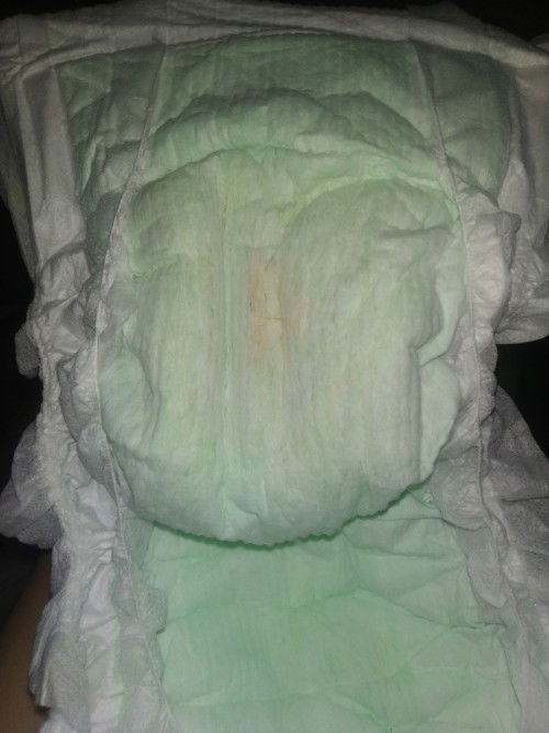 Ciri2 ISK - Ada bercak oranye di popok