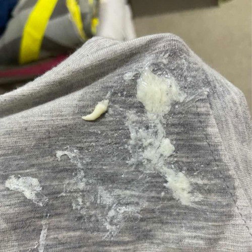 Sharing dong bund! Gumoh bayi