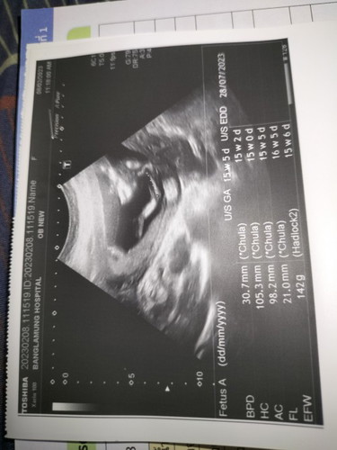 หมอบอกว่ายังบอกเพศไม่ได้