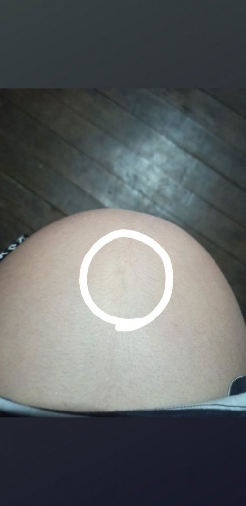 ใครท้องเจ็บตรงนี้บ้างคะ มันเจ็บเพราะอะไร ใครรู้บอกที อันนี้ท้องได้9เดือนแล้วคะ