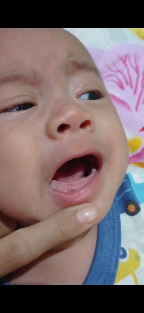 Bayi3 bulan tumbuh gigi