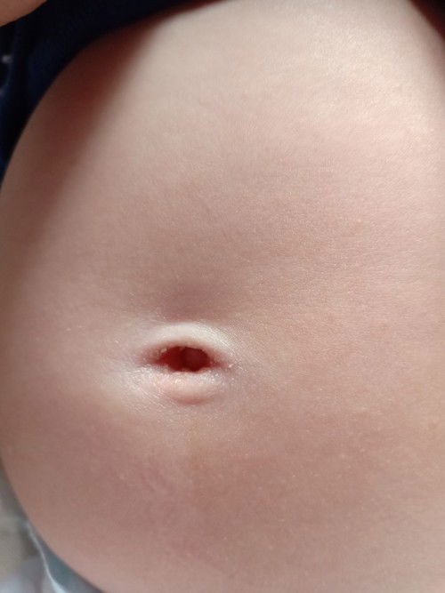 4 months pusod ni baby