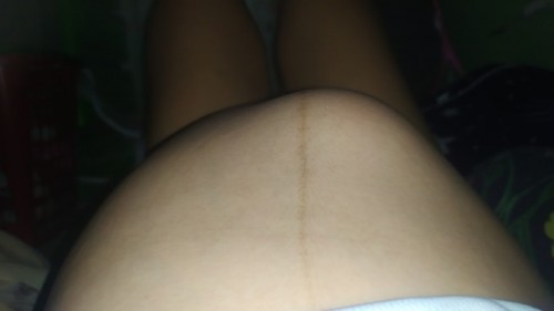 PAGBUKOL NI BABY SA TYAN