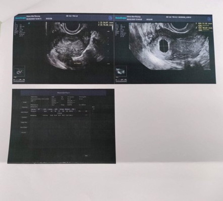 อายุ27จะเข้า28ค่ะ ท้องแรก