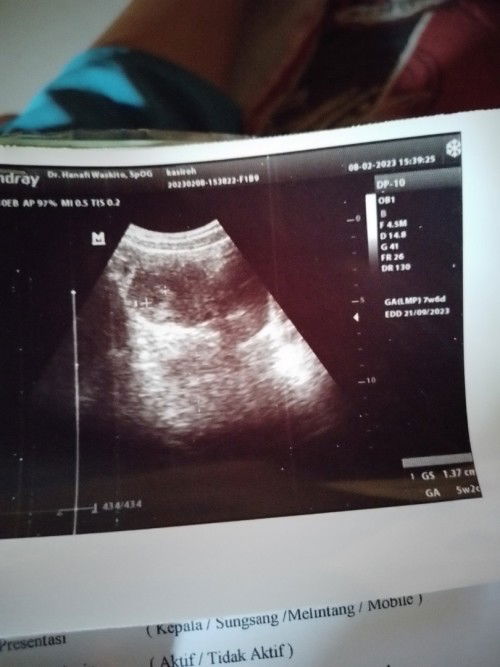 Hpht sma usg beda jauh