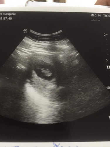 แม่ๆช่วยเดากันหน่อยคะ ว่าน้องกี่เดือนแล้ว คุณหมอให้ที่13W. แต่คุณหมอว่ายังไม่ชัว