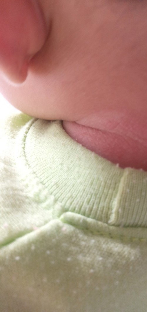 Obat untuk gatal pada bayi