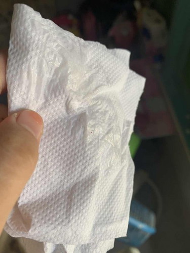 แบบนี้เรียกมูกไหมคะ 37+3