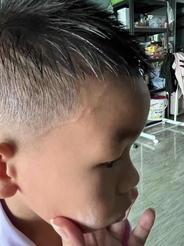 มีลูกบ้านไหนเป็นบ้างเส้นเลือดปูด