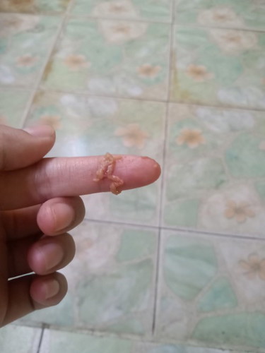 มีอะไรออกมาจากอวัยวะเพศ