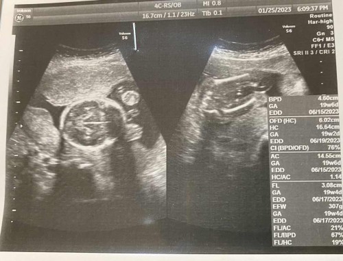 21 weeks แล้วนะ