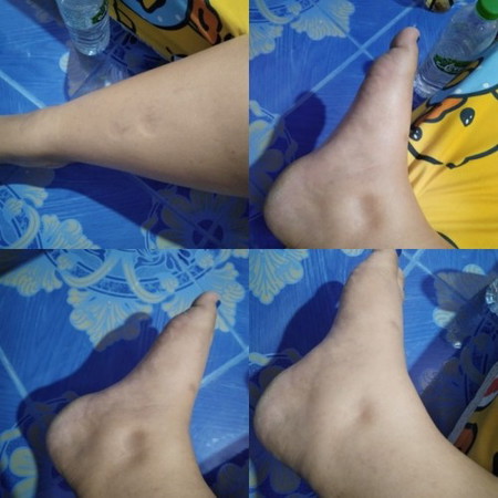 35 wเเล้วค่ะ