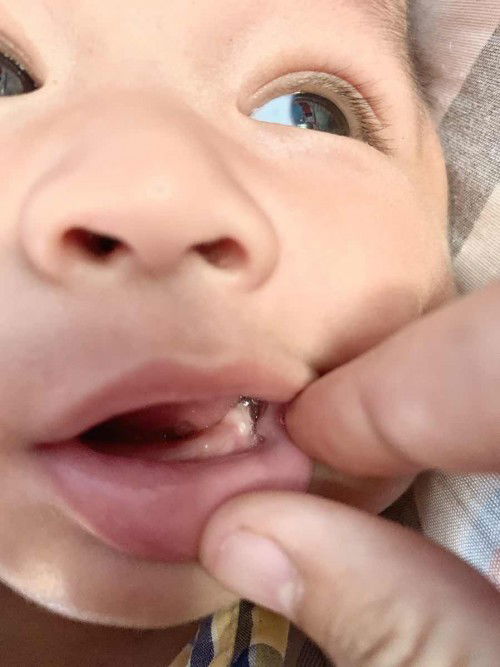 น้อง4เดือน18วันค่ะ