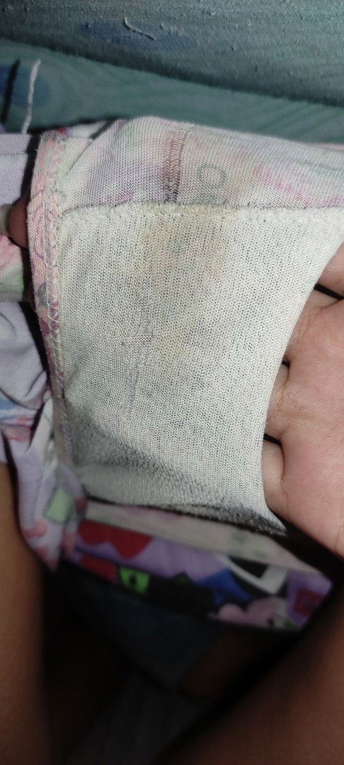 Eto po ba itsura ng spotting?