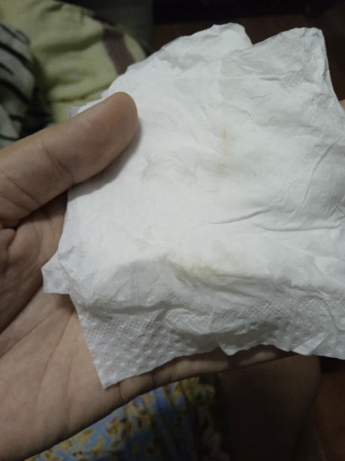 ขออภัยหากรูปไม่เหมาะสม