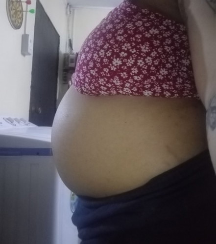 Maliit po ba yung tummy ko para sa 24 weeks?