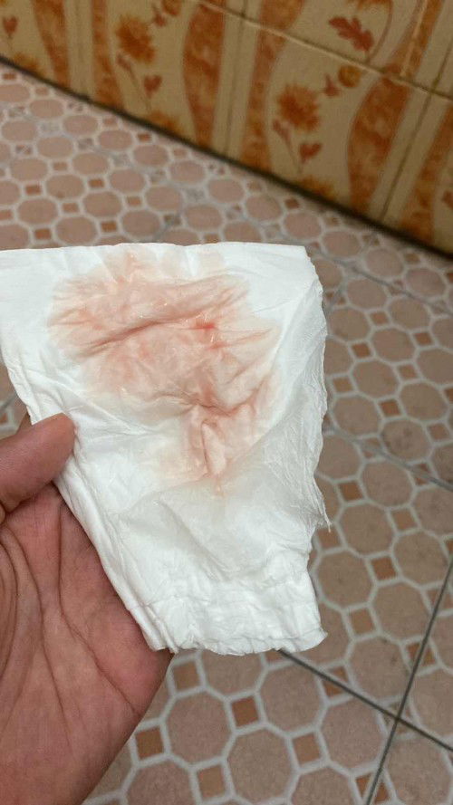 Keluar cairan / lendir berwarna seperti ini itu tanda apa yah bund ? 🙏