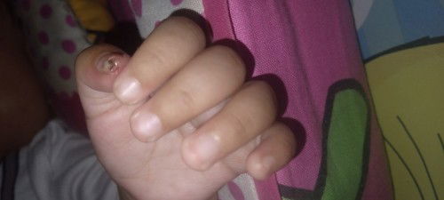 Daging bayi kena gunting kuku