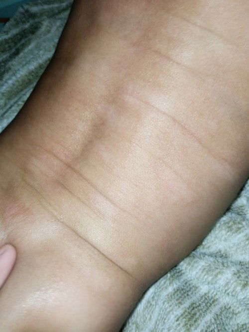 Ber-Cak Putih Bayi meresahkan