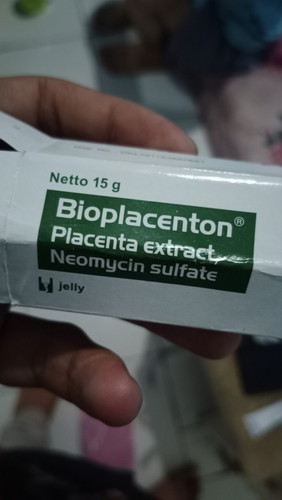 Bun, salep bioplacenton buat luka bakar anak umur 1-2 tahun bagus ga bun?