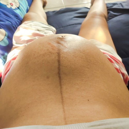 กำหนดคลอด 12 กุมภาพันธ์