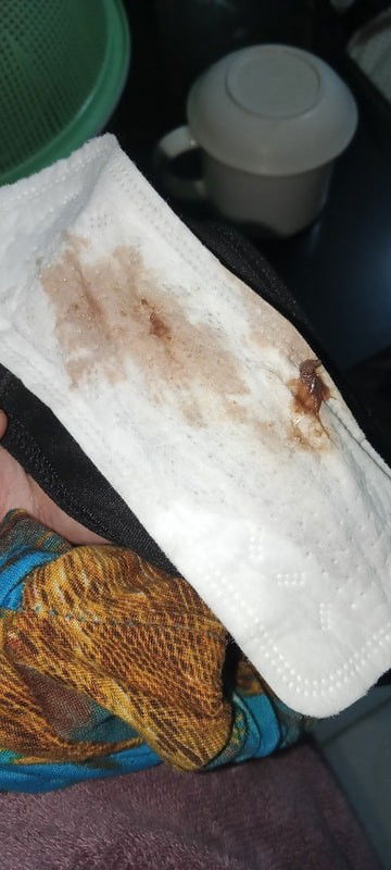 Bleeding after an IE? @40weeks4days Should I be worried na and rush to ER?