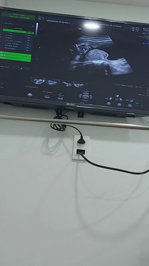 Tử cung hẹp ở giữa