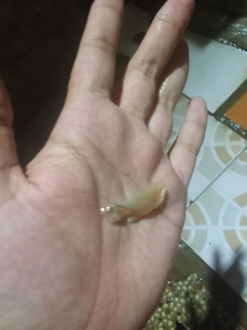 Keluar lendir kental