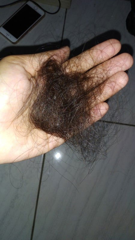 Rambut busui rontok
