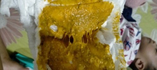 แบบนี้ปกติไหมค่ะ