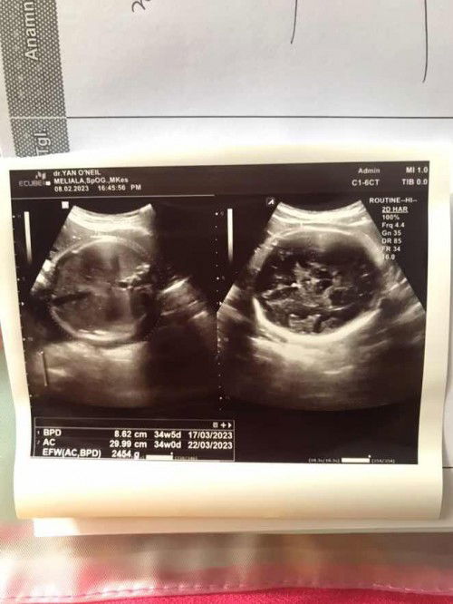 Bunda sharing dong🙏🏻🥰