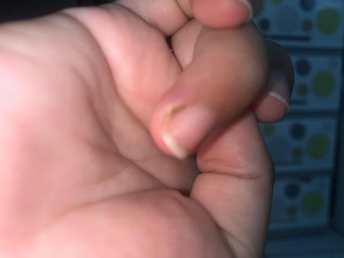 Regla / amoxicillin