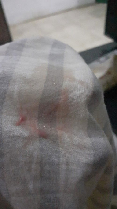 Lendir pink kecoklatan, usia kehamilan 38 minggU