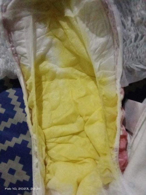 Diarrhea with vomiting 😔