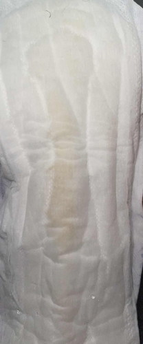 Spotting atau keputihan?