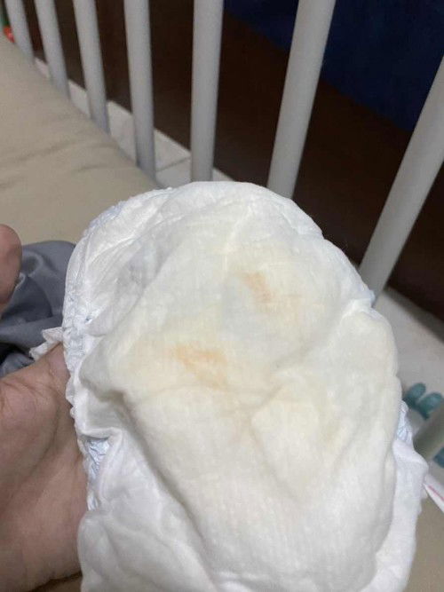 น้อง 10 เดือน ฉี่มีสีแบบนี้ผิดปกติไหมคะ