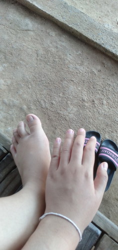 พึ่ง36+2เองค่ะ เเต่มือเท้าเริ่มบวมเเล้ว