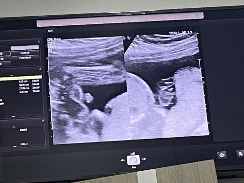 22สัปดาห์ ไปซาว์ที่คลีนิค