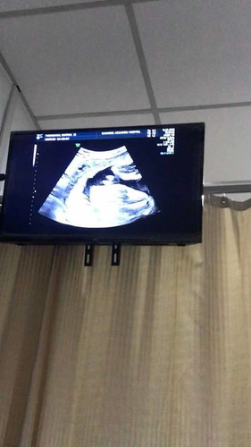 29 สัปดา 5 วัน