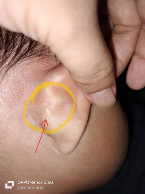Ear bone behind his ear