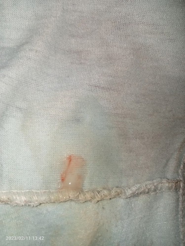 Bun maaf agak jorok hamil 39weeks keluar kayak gitu apa tanda mau lahiran bun.maklum hmil pertama