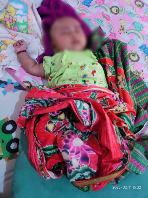 Bayi tidur lebih tinggi kaki drpd kepala
