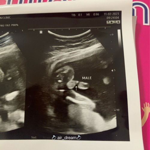 แม่อยากได้ลูกผช.