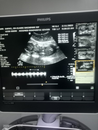 Ultrasound