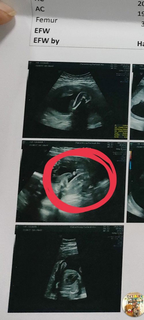 สอบถามเรื่องเพศค่ะ