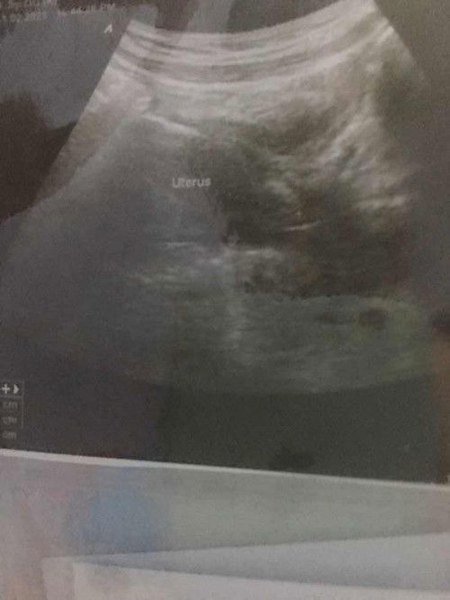 Belum kelihatan kantung kehamilan pas 4week